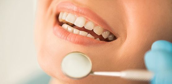 Clínica Dental Dra. Ana Millán persona sonriendo